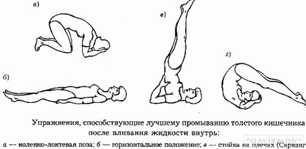 Как Правильно Сделать Клизму Для Анального Секса